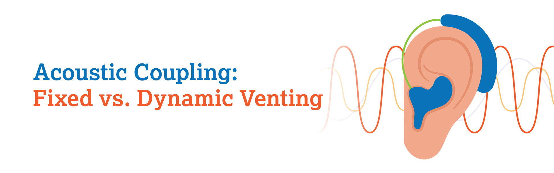 Acoustic Coupling: Fixed vs. Dynamic Venting